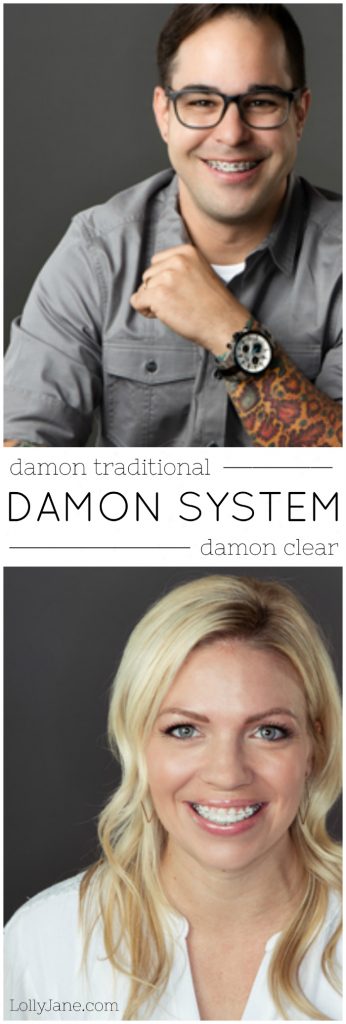 Damon System Braces | Learn all about the benefits of Damon System braces versus traditional braces. We love the advantages of the Damon System!